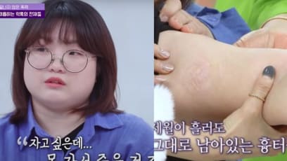 Korean Woman Recalls How She Was Tortured With A Curling Iron In School The Same Way As Song Hye Kyo’s Character In The Glory