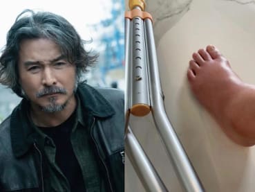 Actor Christopher Lee will miss the Golden Bell Awards ceremony in Taiwan because of a foot injury