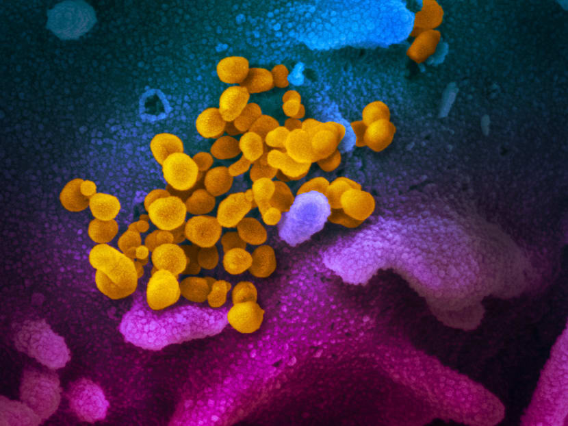 A scanning electron microscope image of the novel coronavirus (yellow) emerging from the surface of cells cultured in the lab.