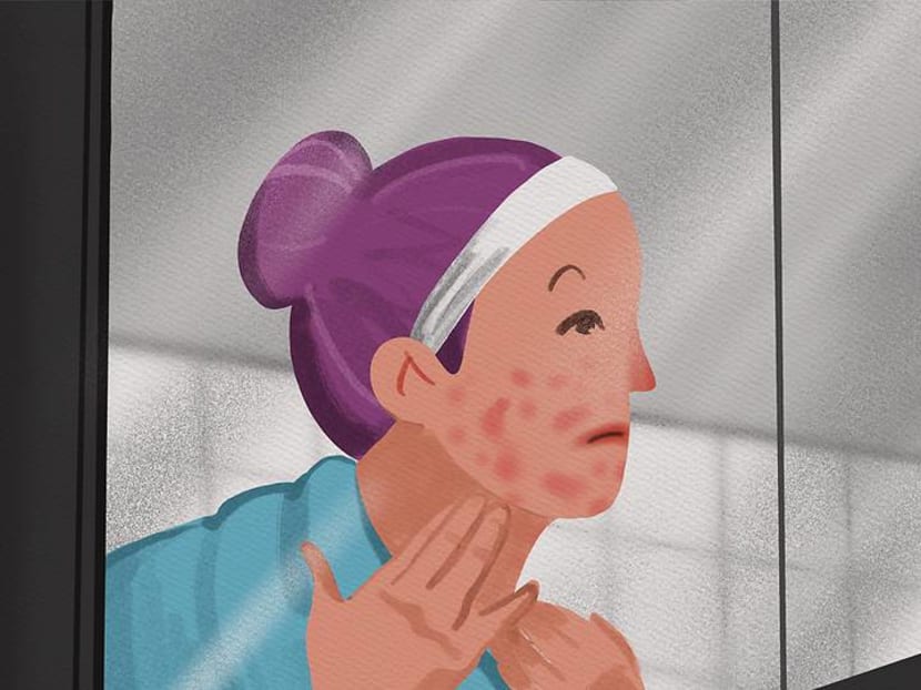 Using the wrong facial beauty products can cause eczema-prone skin to flare up