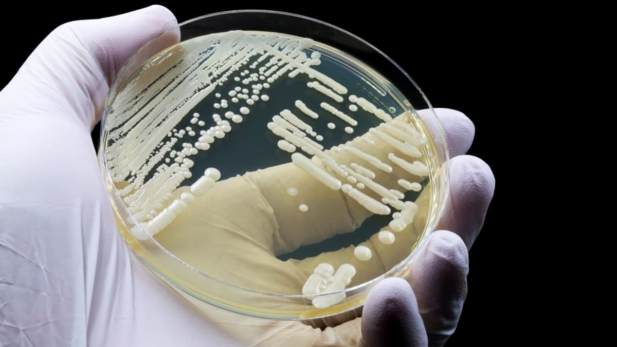 Hong Kong Hospital Authority warns of surge in 2 superbugs, turns to AI in fight against antibiotic overuse