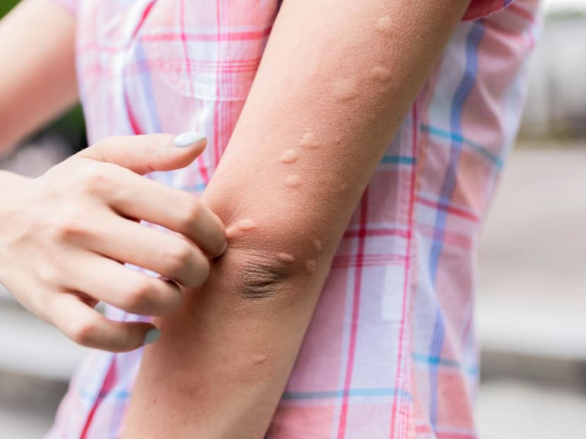 What you need to know – and do – to minimise mosquito bites
