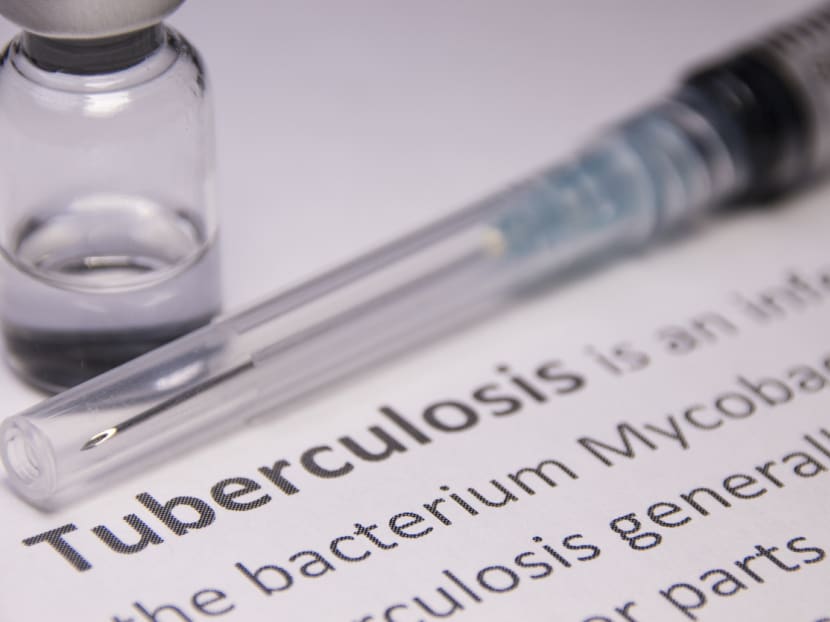 "In Singapore’s path to TB elimination, it is incumbent on us to become progressively more people-centred and reduce the barriers to TB diagnosis and treatment," said the authors.