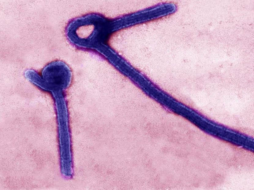 A transmission electron micrograph shows Ebola virus particles in this undated handout file photo released by the US Army Medical Research Institute of Infectious Diseases (USAMRIID) in Fredrick, Maryland. Photo: Reuters