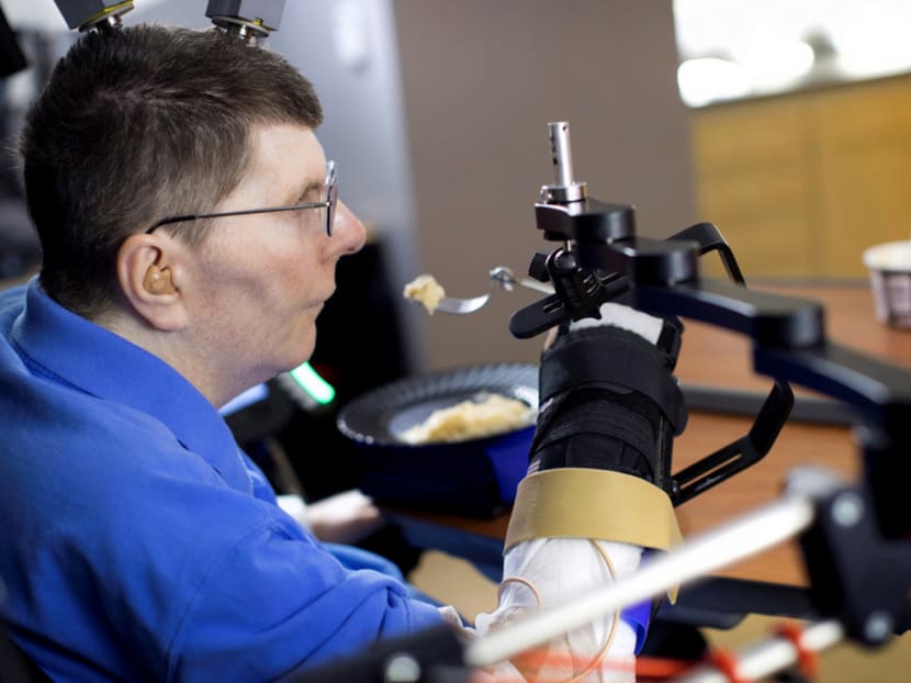 Bill Kochevar eating mashed potatoes with his own arm and hand using computer-brain interface technology and an electrical stimulation system, after eight years of paralysis. Photo: Reuters