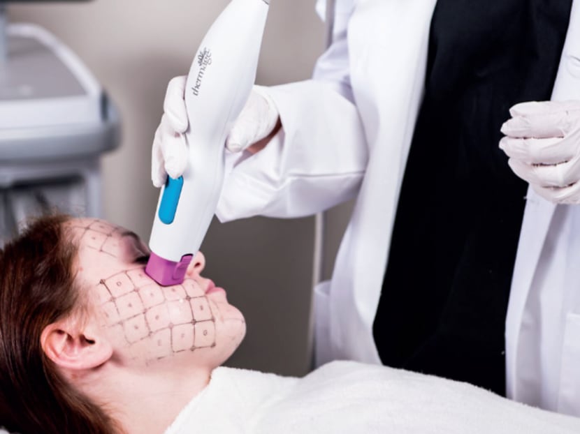 Masks and serums not working for wrinkles? Next-level facial treatments you can save up for Masks and serums not working for wrinkles? Next-level facial treatments you can save up for