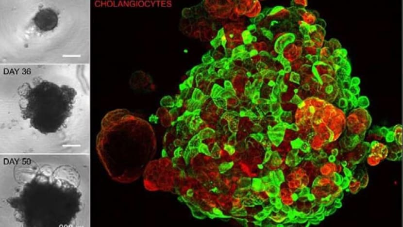 Singapore scientists take major step in finding new therapies for non-alcoholic fatty liver disease Singapore scientists take major step in finding new therapies for non-alcoholic fatty liver disease