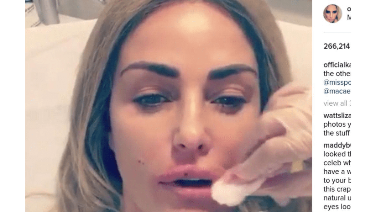 Katie Price Gets Her Lips Plumped 8 Days