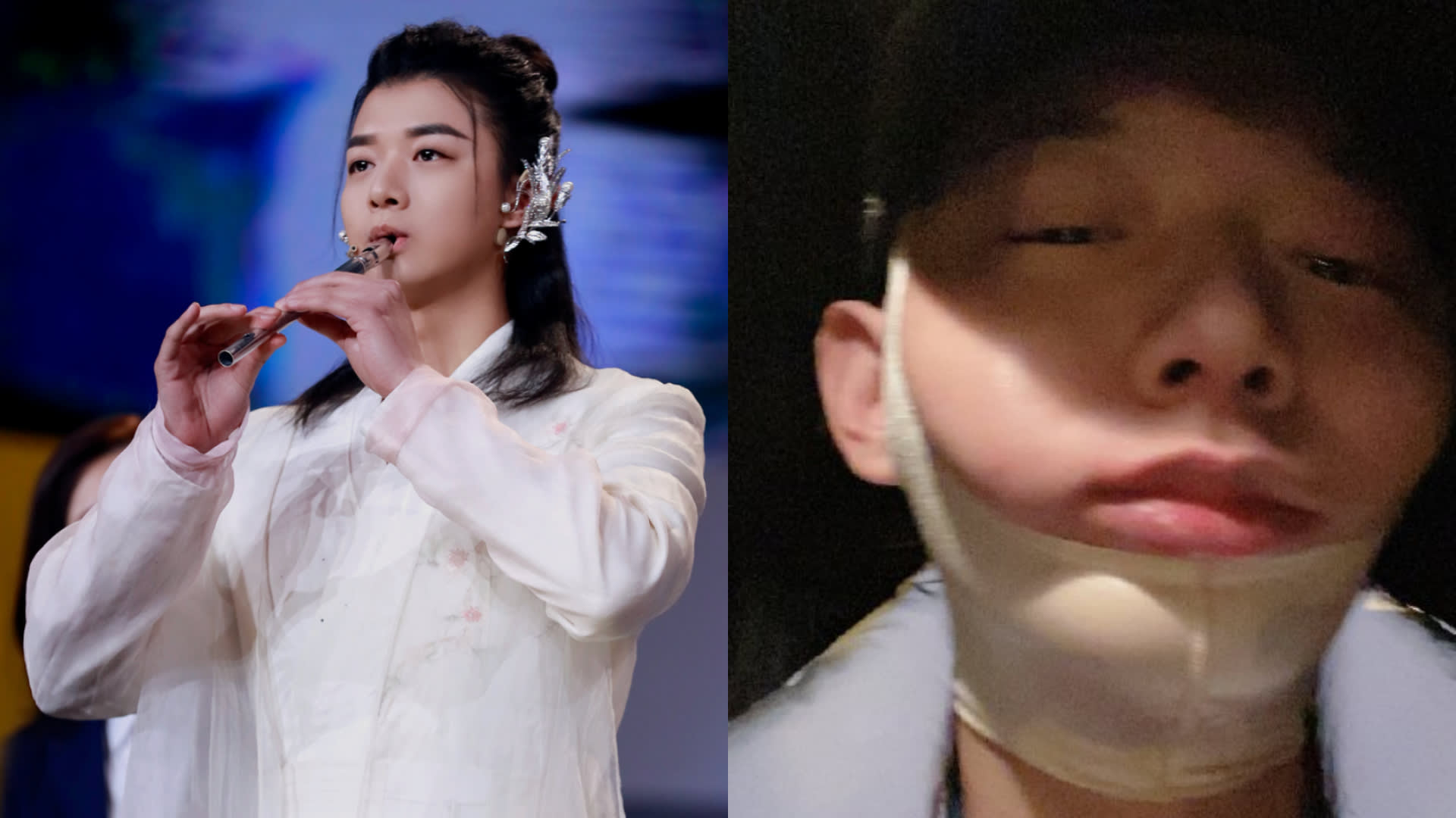 This Chinese Singer Dislocated His Jaw When He Yawned And Had To Go To The Emergency Room This Chinese Singer Dislocated His Jaw When He Yawned And Had To Go To The Emergency Room