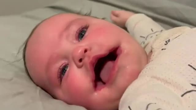 澳洲女婴患巨口症“永远微笑” 成网红 网暖喊：很可爱