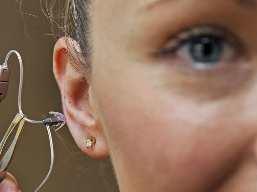 A hearing aid. AFP file photo