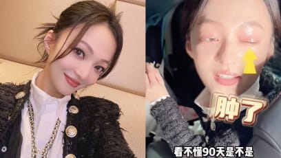 Angela Chang Loses It As She Fails To Remove False Eyelashes That She Applied Using “Long-Lasting Eyelash Extension Glue” Bought By Male Assistant