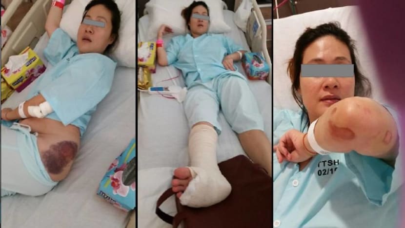 Woman who sued PUB for S$5 million after falling into manhole accepts settlement offer Woman who sued PUB for S$5 million after falling into manhole accepts settlement offer