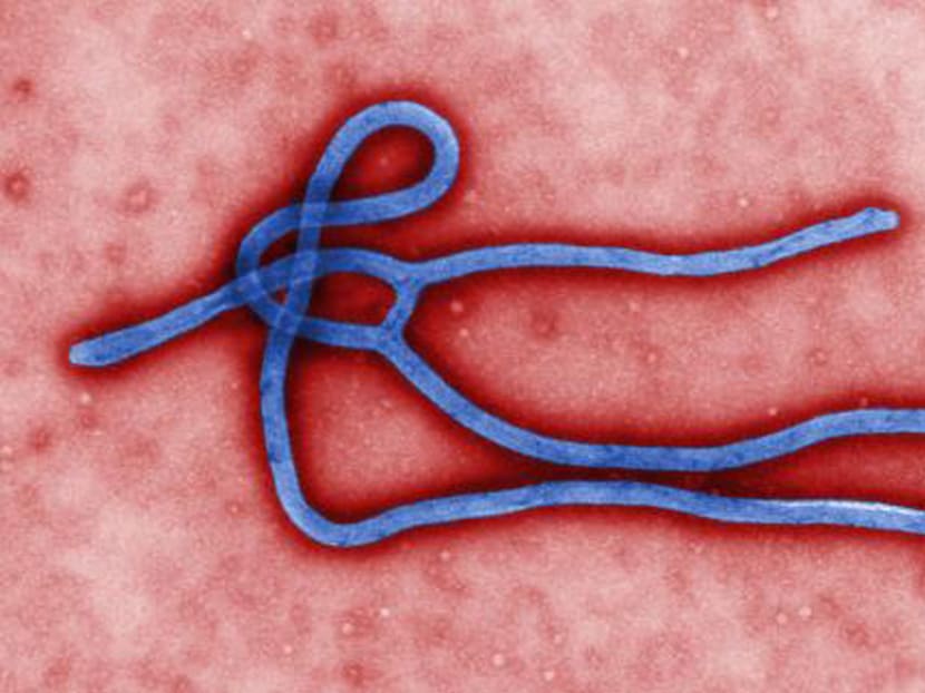 Ebola Virus. Photo: AP