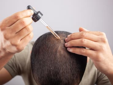 Minoxidil for hair loss: What you need to know about this widely used drug to restore hair growth