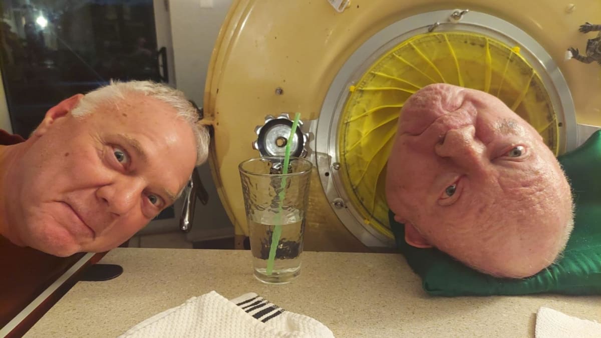 US man who lived seven decades in iron lung dies at 78 US man who lived seven decades in iron lung dies at 78