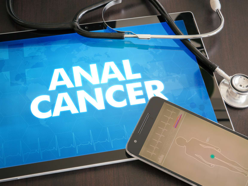 Anal cancer risk increases due to greater exposure to virus linked to cervical cancer, multiple sex partners