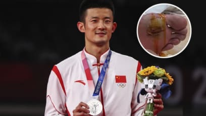 Chinese Olympic Shuttler Chen Long Was Called “Useless” For Not Winning Badminton Gold; Coach Reveals How Badly Blistered His Feet Were During Match