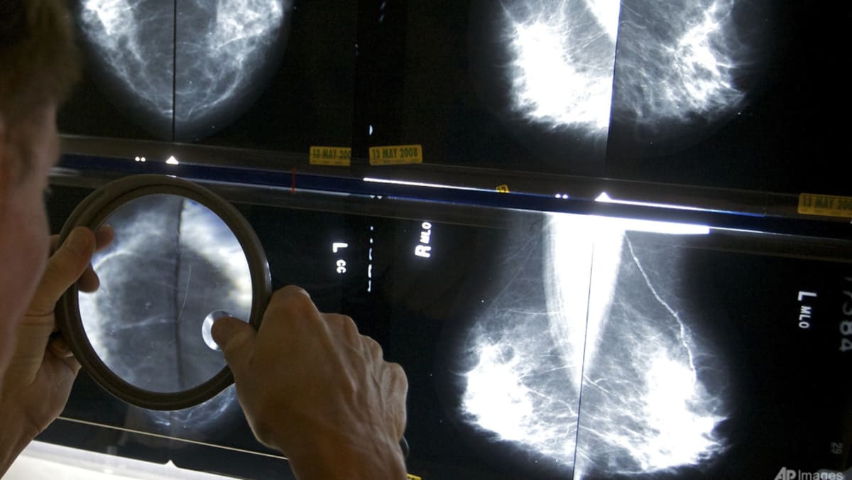 AI-Support Mammogram Screening Increases Breast Cancer Detection