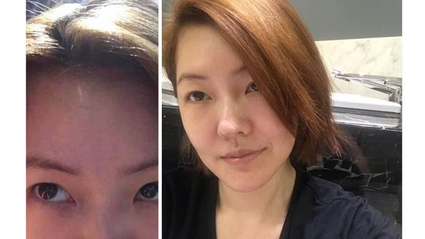 Dee Hsu admits to undergoing face slimming treatments