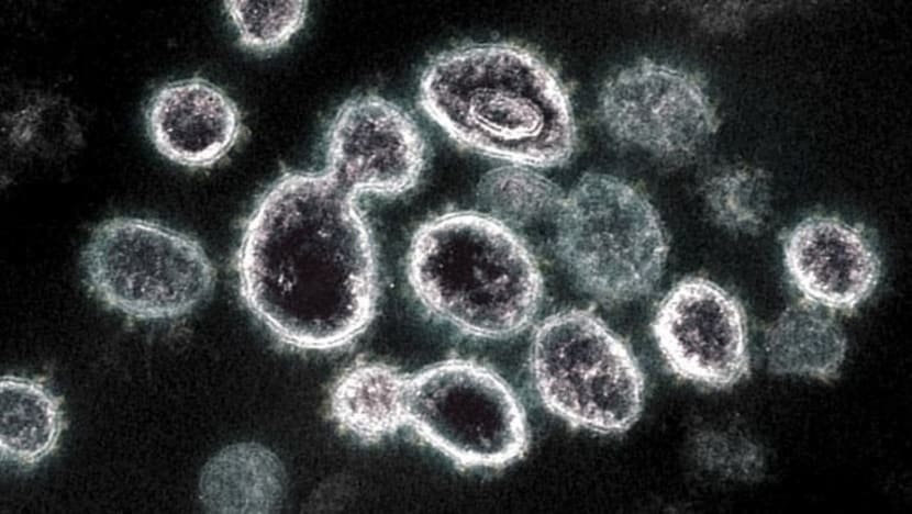 Pandemik selepas COVID-19 mungkin lebih berbahaya, kata pencipta vaksin