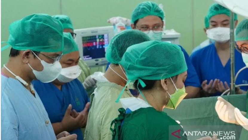 Bayi kembar 2 kepala 1 tubuh di Palembang meninggal dunia 3 jam selepas dilahirkan