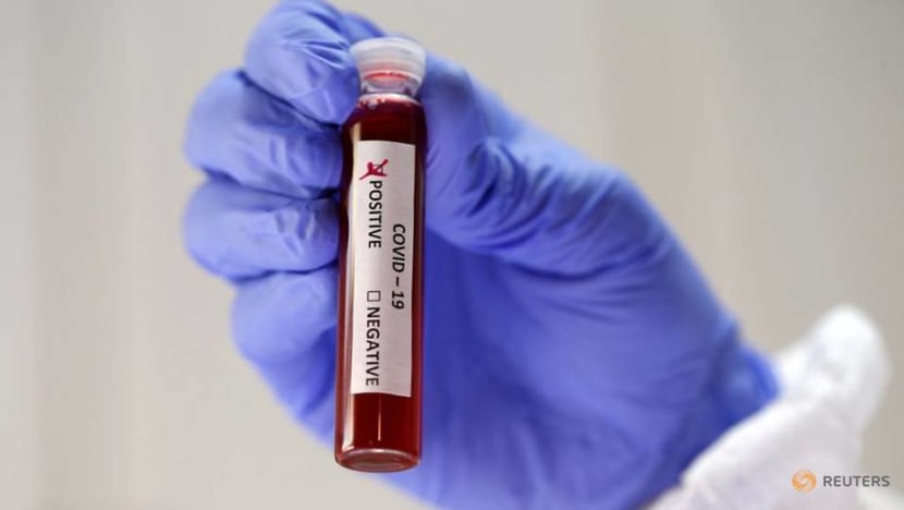 Dutch, Belgian patients reinfected with COVID-19 virus: Report Dutch, Belgian patients reinfected with COVID-19 virus: Report