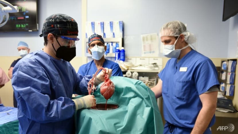 Commentary: Genetically engineered pigs may shorten organ transplant wait list Commentary: Genetically engineered pigs may shorten organ transplant wait list