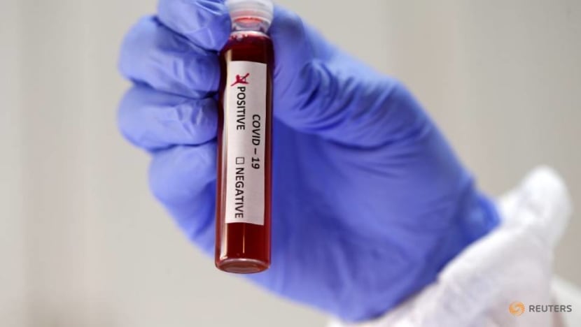 Commentary: Are people with blood group A at higher risk of catching COVID-19? Commentary: Are people with blood group A at higher risk of catching COVID-19?