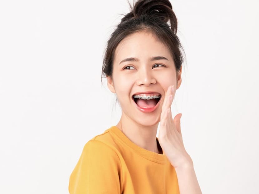 Why I’m wearing metal braces for the second time, even though invisible braces are a trend Why I’m wearing metal braces for the second time, even though invisible braces are a trend