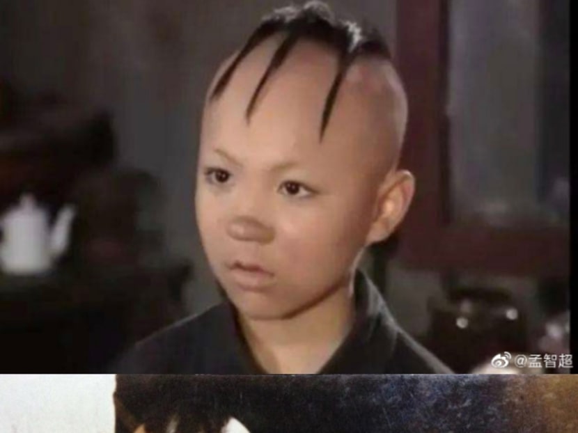 Former Child Star Needed Hair Transplant Surgery After Shaving His Head ...