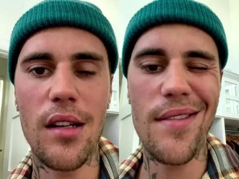 Justin Bieber Reveals He Has Facial Paralysis Caused by Ramsay Hunt Syndrome