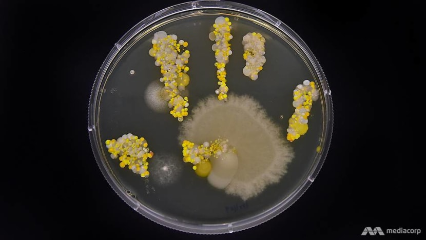 In pictures: The bacteria living on your hands right now