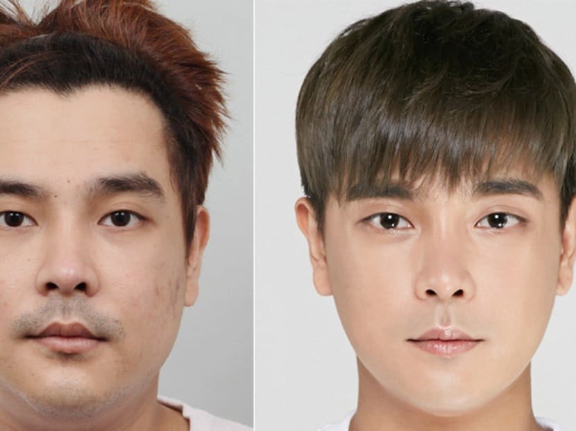 Asian shop face surgery