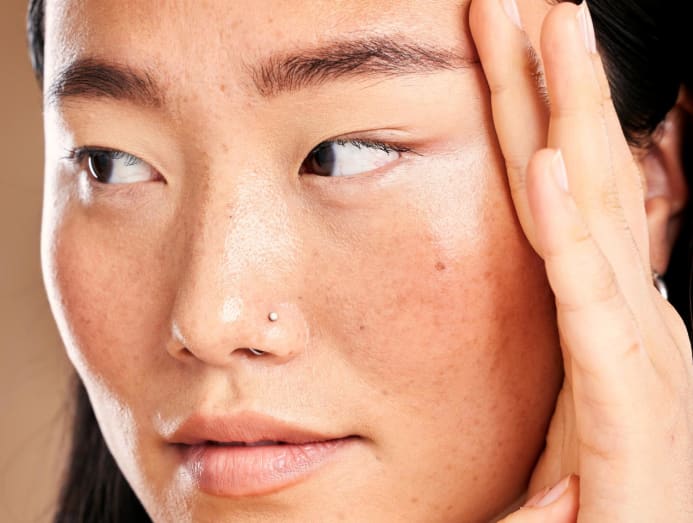 What's The Difference Between Freckles And Sun Spots?: Center Aesthetic &  Dermatology