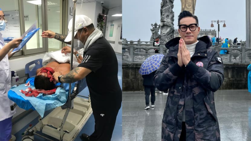 HK Actor Jason Wong Who Was Slashed In The Face Last Year Says His