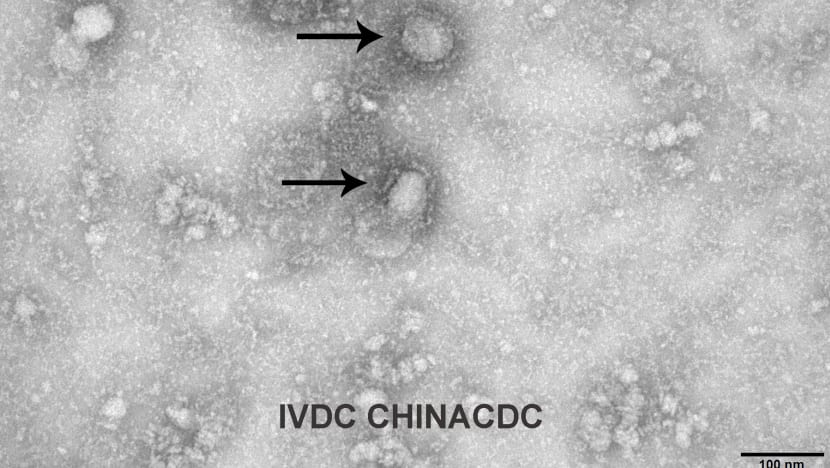 Commentary: Does it really matter if WHO hasn't designated Wuhan virus a global public health emergency? Commentary: Does it really matter if WHO hasn't designated Wuhan virus a global public health emergency?