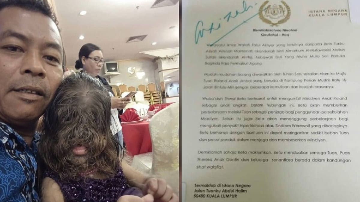 Malaysia's Queen expresses wish to adopt Sarawakian girl, 2, with 'Werewolf Syndrome'