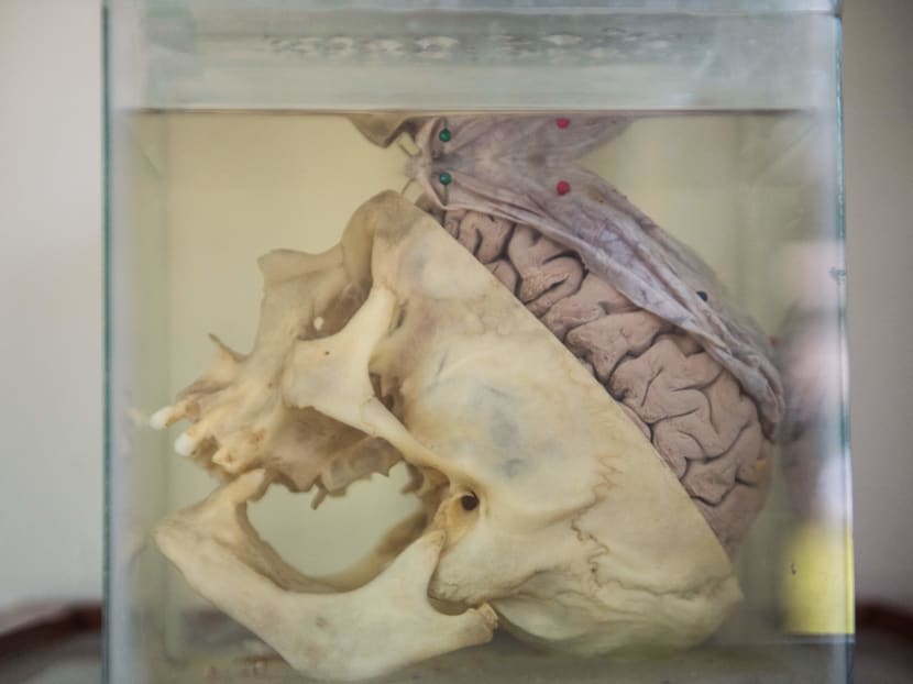 Gallery: Peru brain museum puts most complex organ on display