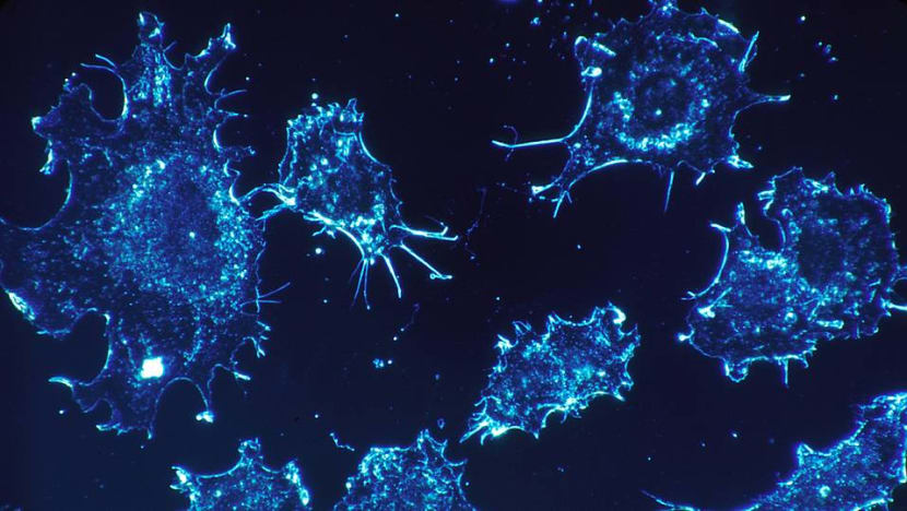 Singapore scientists discover new viruses that help identify people at high risk of Cantonese cancer Singapore scientists discover new viruses that help identify people at high risk of Cantonese cancer