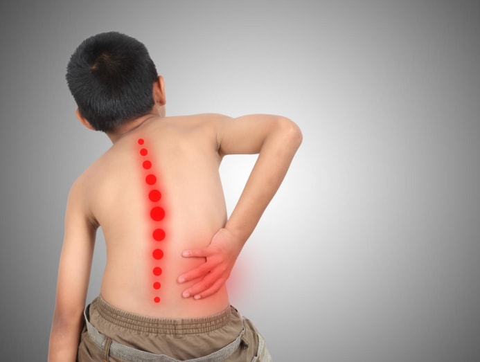 Scoliosis is found to start in the brain, not posture or heavy bags