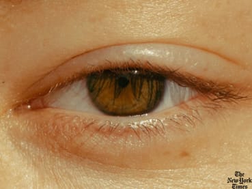 What is prosopagnosia, Brad Pitt's ‘face blindness’ condition? 