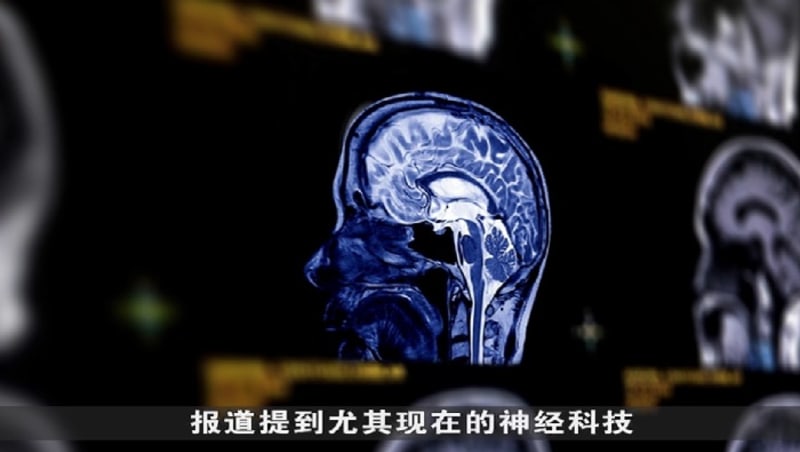 晨光|纸上风云：美国宣布新法案 保护大脑神经数据