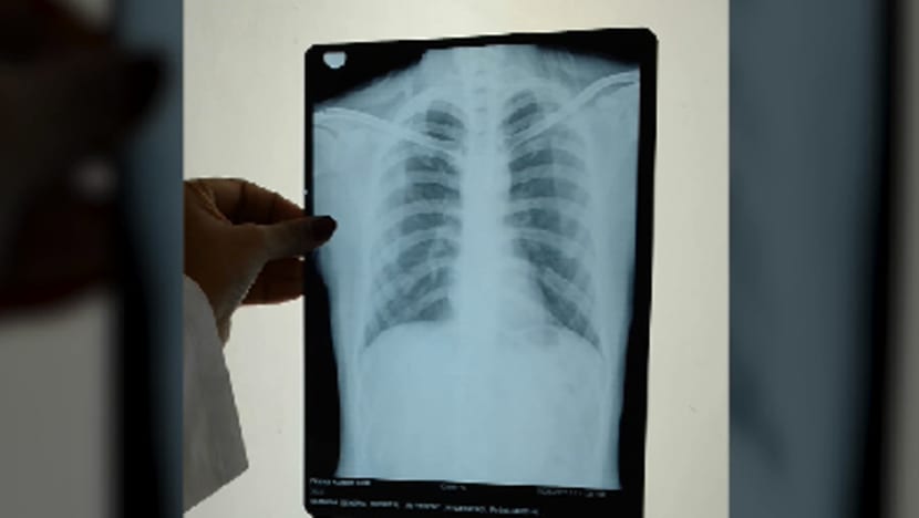 15 disyaki hidap penyakit radang paru-paru Wuhan di Hong Kong