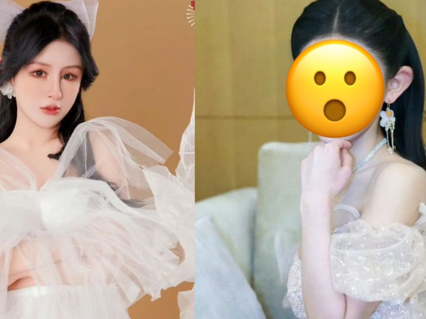 Chinese influencer, 20, has spent more than S$746,500 on hundreds of plastic surgery procedures since she was 13
