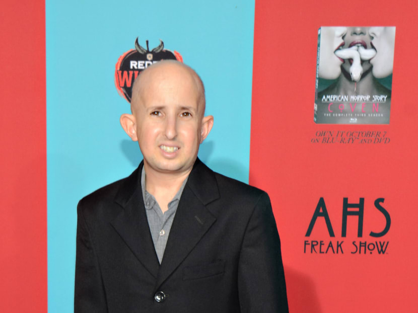 In this Oct 5, 2014 file photo, Ben Woolf was at the premiere screening of American Horror Story: Freak Show at TCL Chinese Theatre, in Los Angeles. He died after being hit by the side mirror of a passing vehicle. Photo: AP