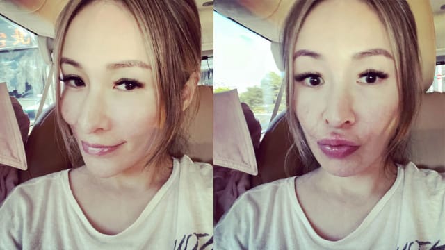 不遮了！萧亚轩素颜“狗咬伤右脸”疤痕现形
