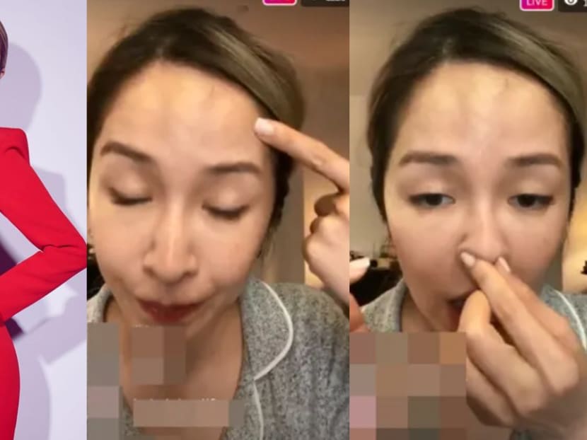 Netizens Think Elva Hsiao, Who's Revealed She'd Undergone Plastic Surgery Before, Recently Got Her Nose Done Too