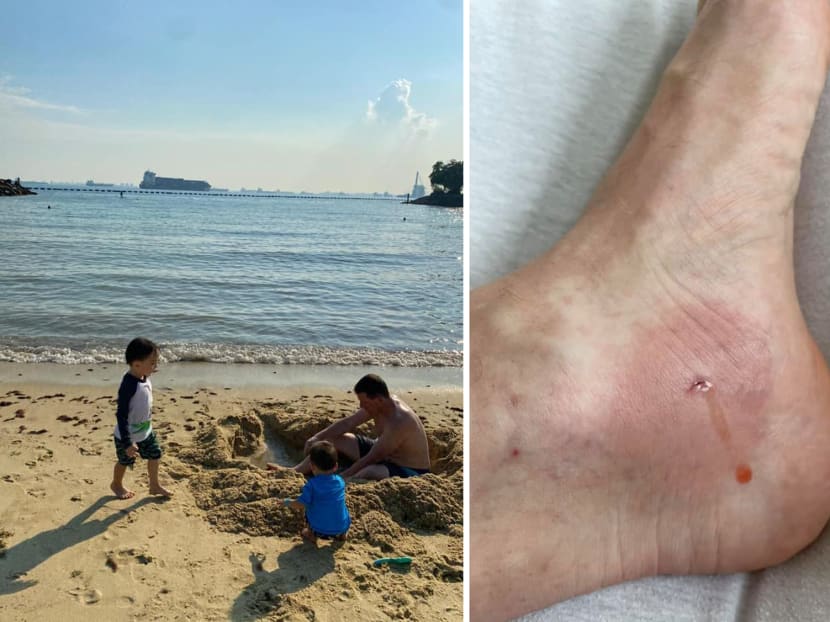 Mr Benjamin Koellmann, a German national and personalised employment pass holder, was stung by a stingray at Tanjong Beach.