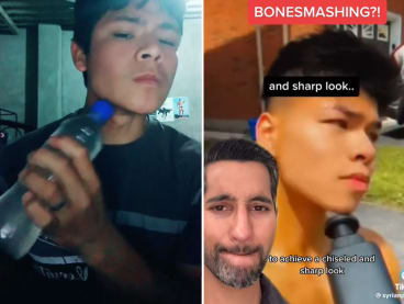 The recently viral ‘bone smashing’ TikTok trend advocating restructuring jawlines and cheekbones through blunt force trauma has experts warning against the health detriments of such practices.
